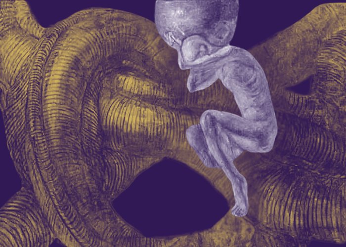 Adaptations of Lurid Dreams